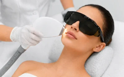 Depilación Láser Facial: Bozo, Mentón, Cejas y Patillas